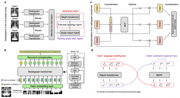 REFERS workflow. Researchers forward radiographs of the k-th patient study through the radiograph transformer, fuse representations of different views using an attention mechanism, and use report generation and study–report representation consistency reinforcement to exploit the information in radiology reports. Graph a, an overview of the whole pipeline. Graph b, the architecture of the radiograph transformer. Graph c, attention for view fusion is elaborated. MLP stands for a multi-layer perceptron. Graph d, two supervision tasks are shown, report generation and study–report representation consistency reinforcement.