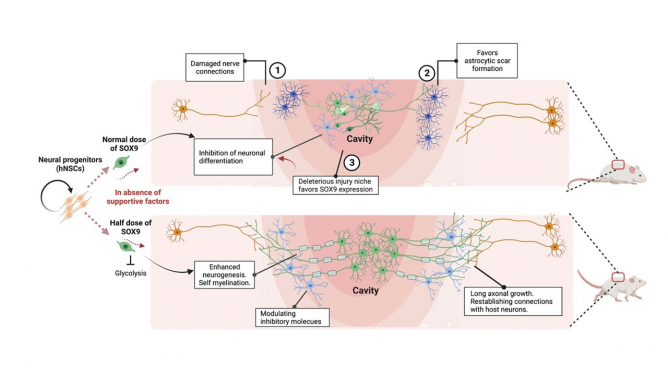 Spinal cord injury (SCI) causes nerve damage and the injury environment favours SOX9 expression; grafting of hNSCs with a half dose of SOX9 acquires unique intrinsic capacity resulting in enhanced neurogenesis, long axonal growth, and establishing neuronal connectivity with the host that restores walking capacity and temperature sensation of the SCI animals.
 